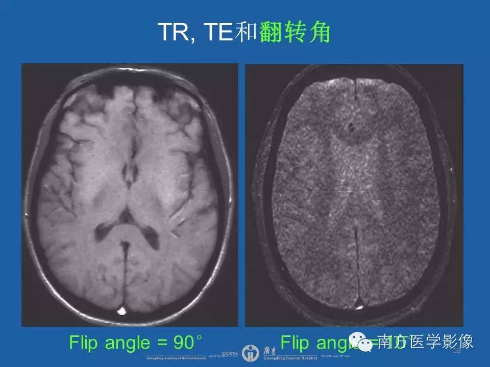 影像PPT - 【PPT】磁共振图像的信噪比-18