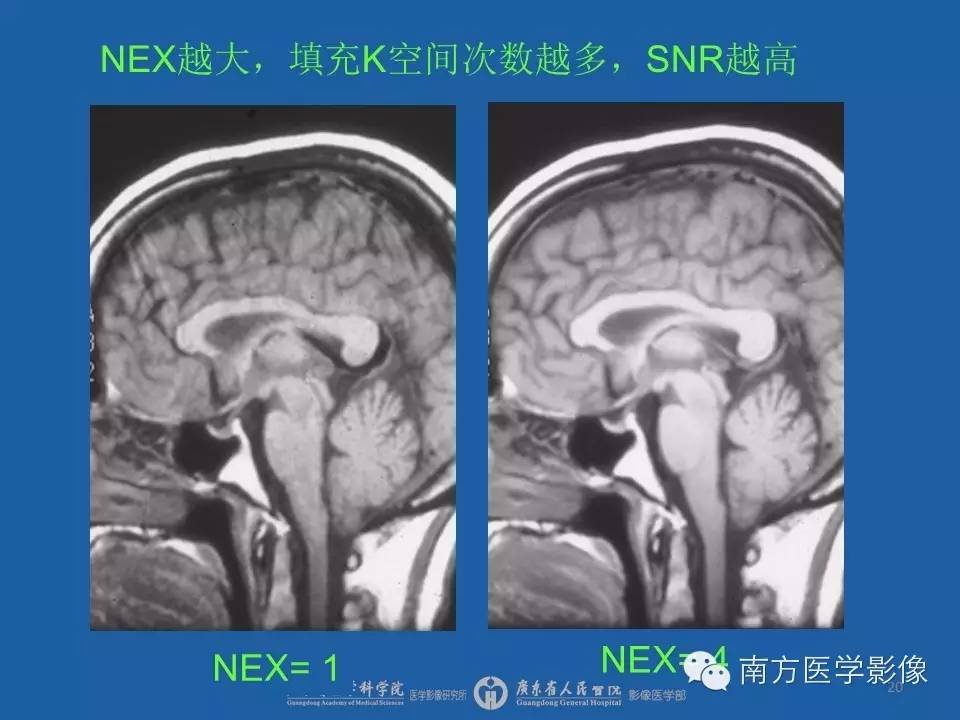 影像PPT - 【PPT】磁共振图像的信噪比-20