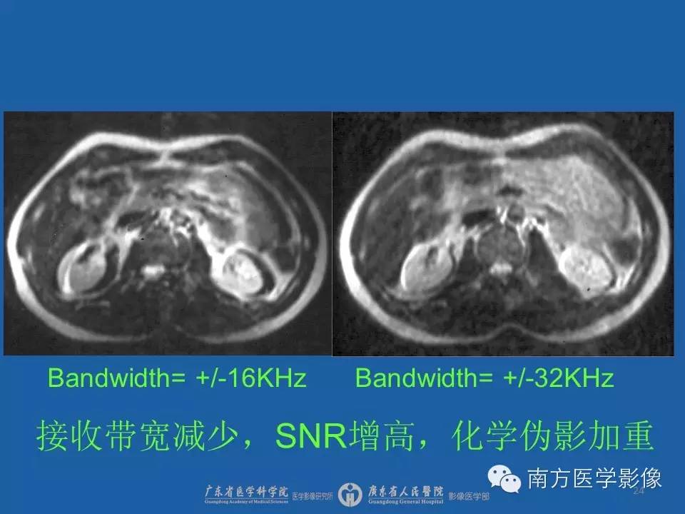 影像PPT - 【PPT】磁共振图像的信噪比-24