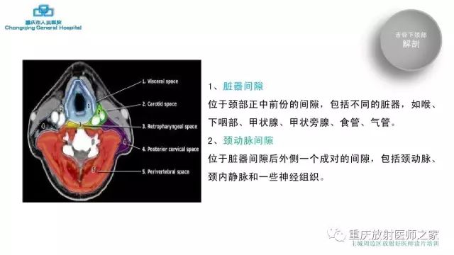 影像PPT - 【PPT】舌骨下颈部间隙划分及常见疾病的影像诊断-5