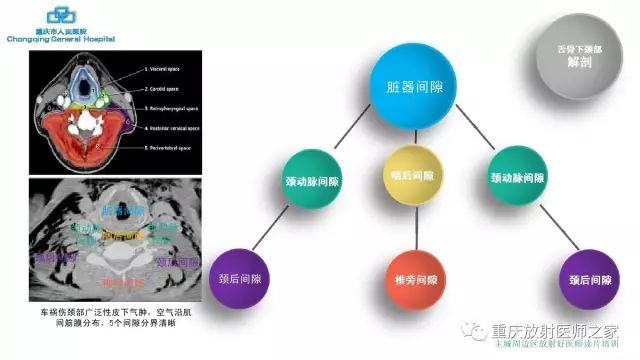 影像PPT - 【PPT】舌骨下颈部间隙划分及常见疾病的影像诊断-7