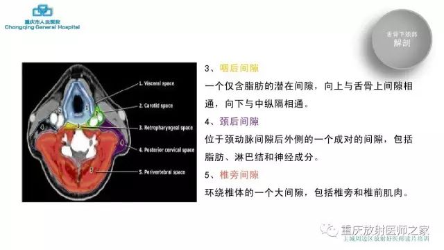 影像PPT - 【PPT】舌骨下颈部间隙划分及常见疾病的影像诊断-6