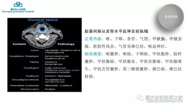 影像PPT - 【PPT】舌骨下颈部间隙划分及常见疾病的影像诊断-10