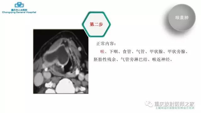 影像PPT - 【PPT】舌骨下颈部间隙划分及常见疾病的影像诊断-14