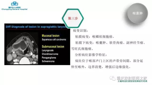 影像PPT - 【PPT】舌骨下颈部间隙划分及常见疾病的影像诊断-15