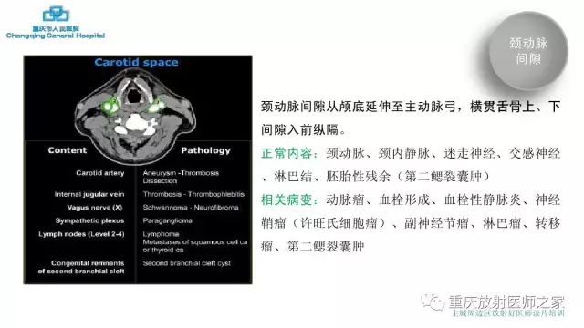 影像PPT - 【PPT】舌骨下颈部间隙划分及常见疾病的影像诊断-37