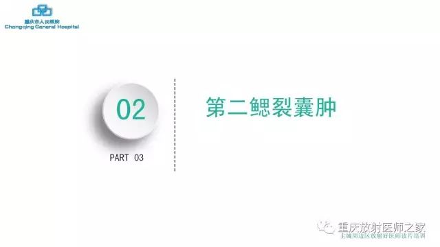 影像PPT - 【PPT】舌骨下颈部间隙划分及常见疾病的影像诊断-44