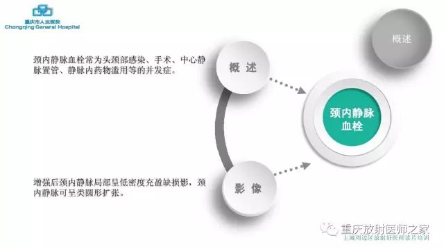 影像PPT - 【PPT】舌骨下颈部间隙划分及常见疾病的影像诊断-48