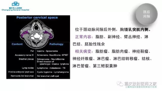影像PPT - 【PPT】舌骨下颈部间隙划分及常见疾病的影像诊断-56