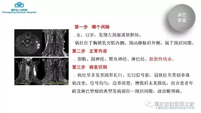 影像PPT - 【PPT】舌骨下颈部间隙划分及常见疾病的影像诊断-65