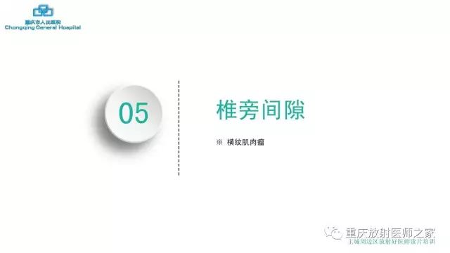 影像PPT - 【PPT】舌骨下颈部间隙划分及常见疾病的影像诊断-66