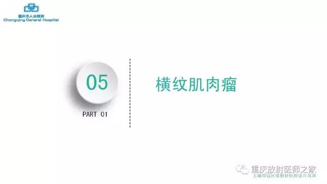 影像PPT - 【PPT】舌骨下颈部间隙划分及常见疾病的影像诊断-68