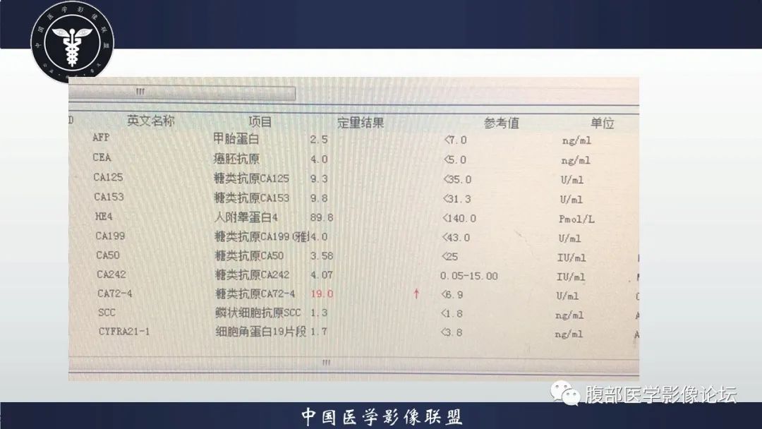 影像PPT - 【病例】卵巢高级别浆液性癌1例CT影像-3 影像PPT - 【病例】卵巢高级别浆液性癌1例CT影像-3