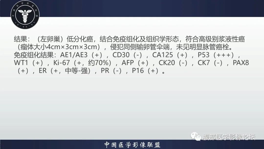 影像PPT - 【病例】卵巢高级别浆液性癌1例CT影像-8 影像PPT - 【病例】卵巢高级别浆液性癌1例CT影像-8
