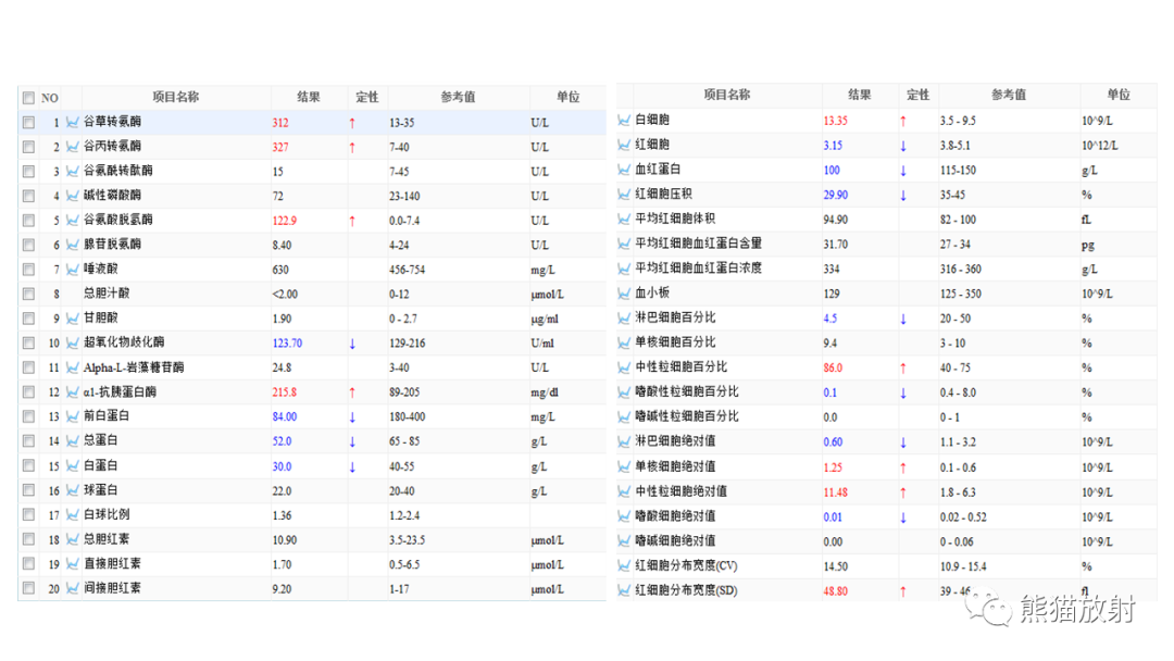 影像PPT - 【病例】肝脏胆管囊腺瘤2例MR影像-3