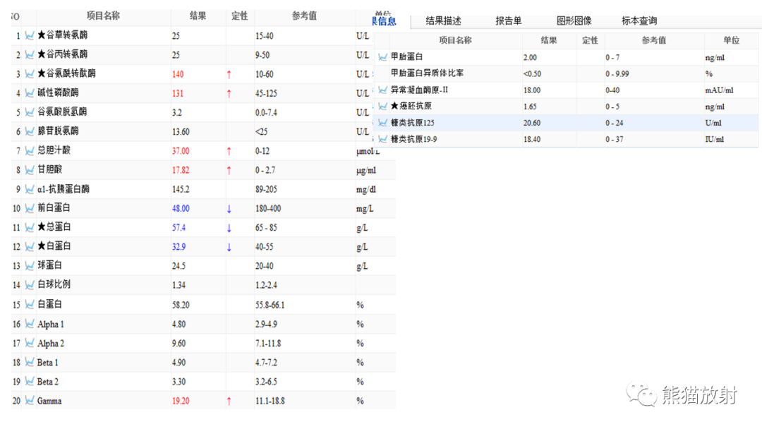 影像PPT - 【病例】肝脏胆管囊腺瘤2例MR影像-17
