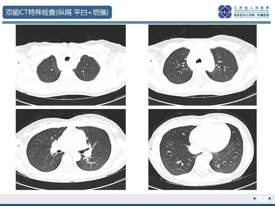 影像PPT - 【PPT】纵隔血管瘤-3