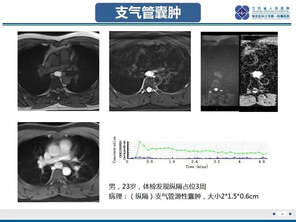 影像PPT - 【PPT】纵隔血管瘤-38