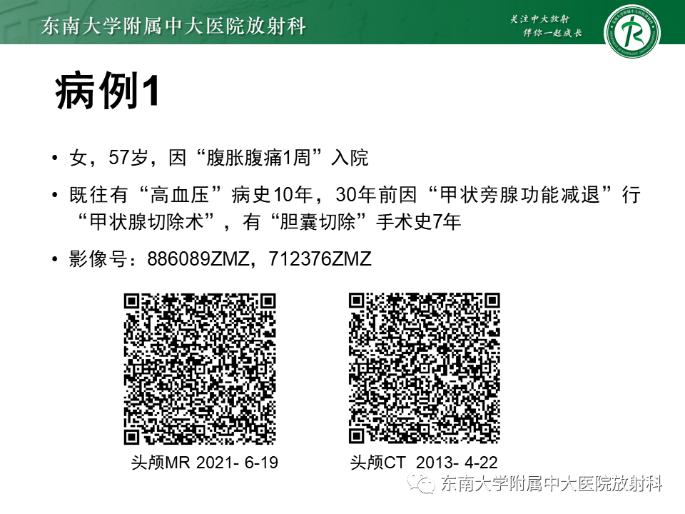 影像PPT - 【PPT】颅内多发钙化病例随诊-1
