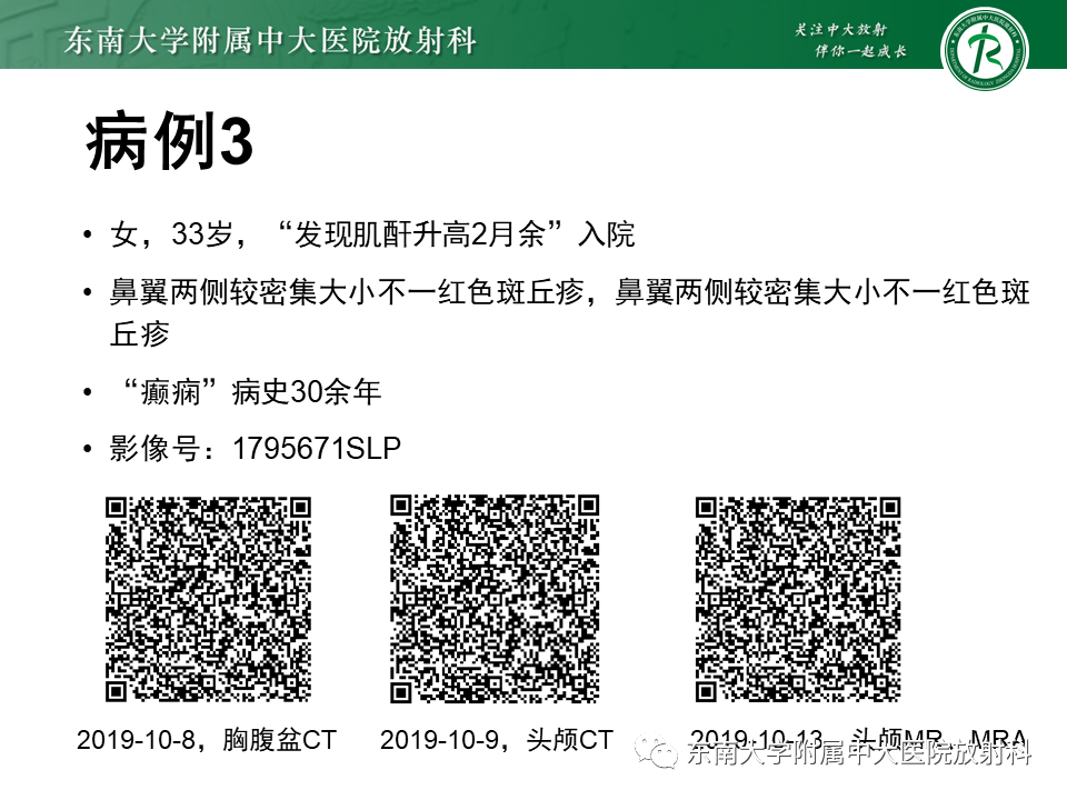 影像PPT - 【PPT】颅内多发钙化病例随诊-6
