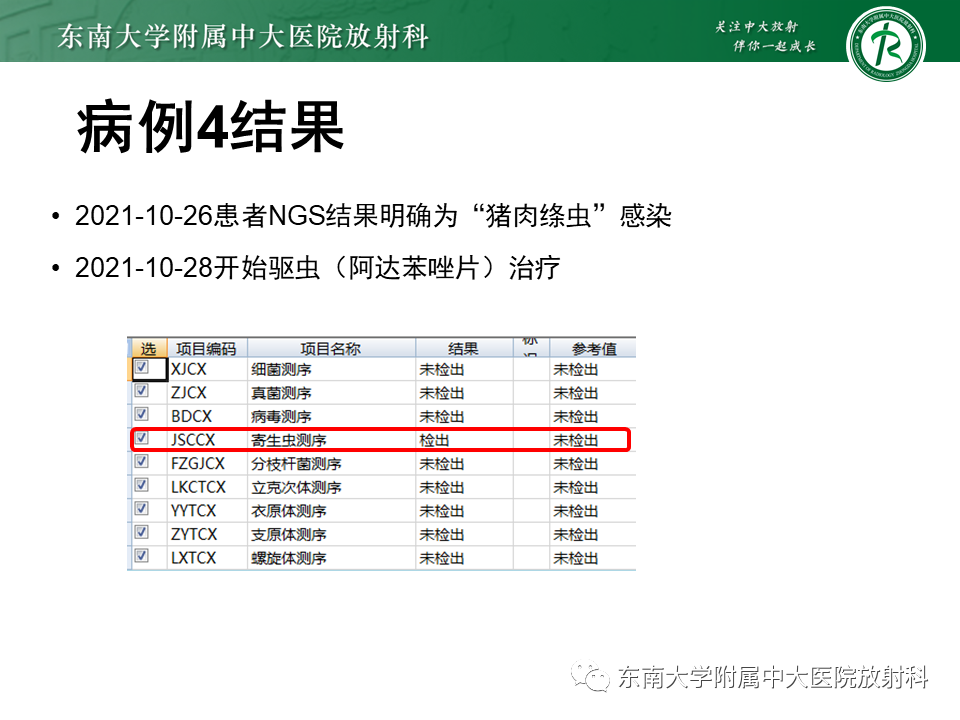 影像PPT - 【PPT】颅内多发钙化病例随诊-15