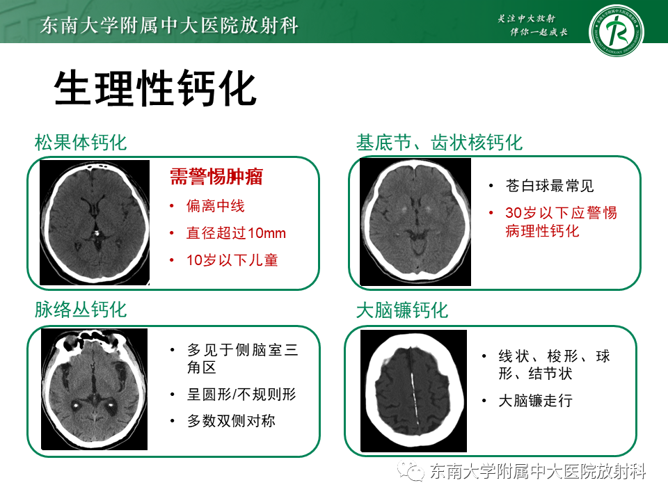 影像PPT - 【PPT】颅内多发钙化病例随诊-20