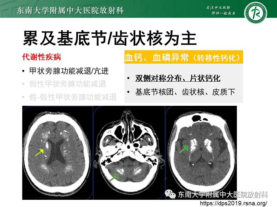 影像PPT - 【PPT】颅内多发钙化病例随诊-23