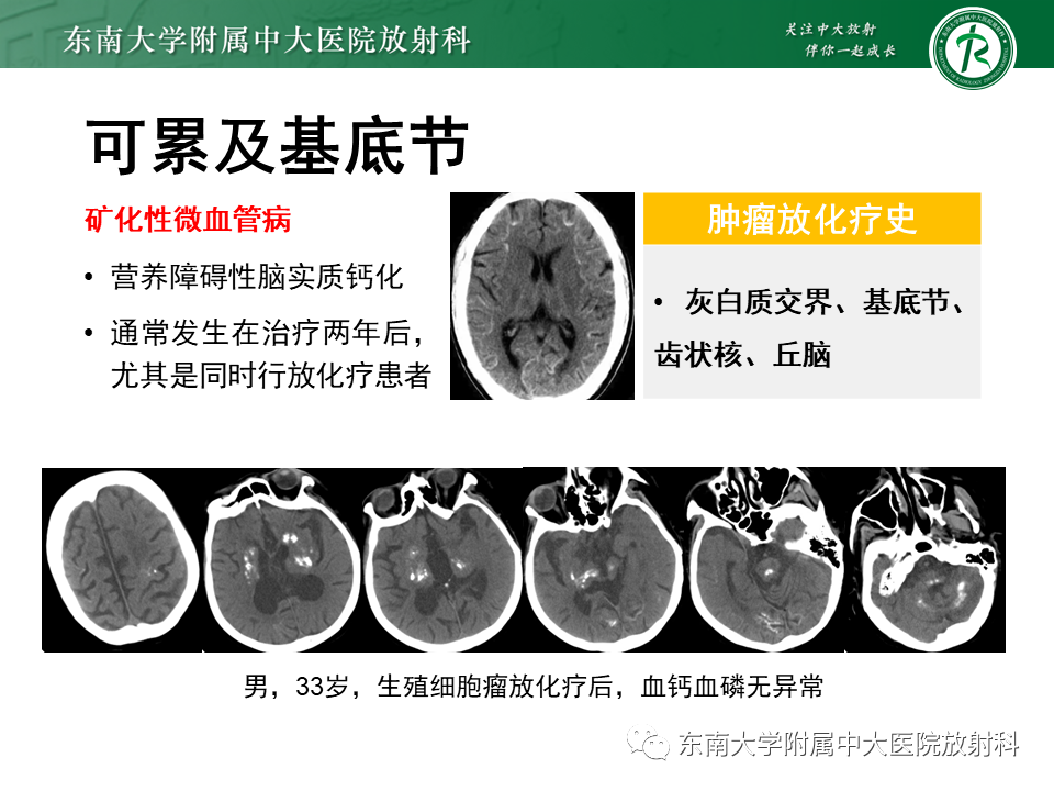 影像PPT - 【PPT】颅内多发钙化病例随诊-29