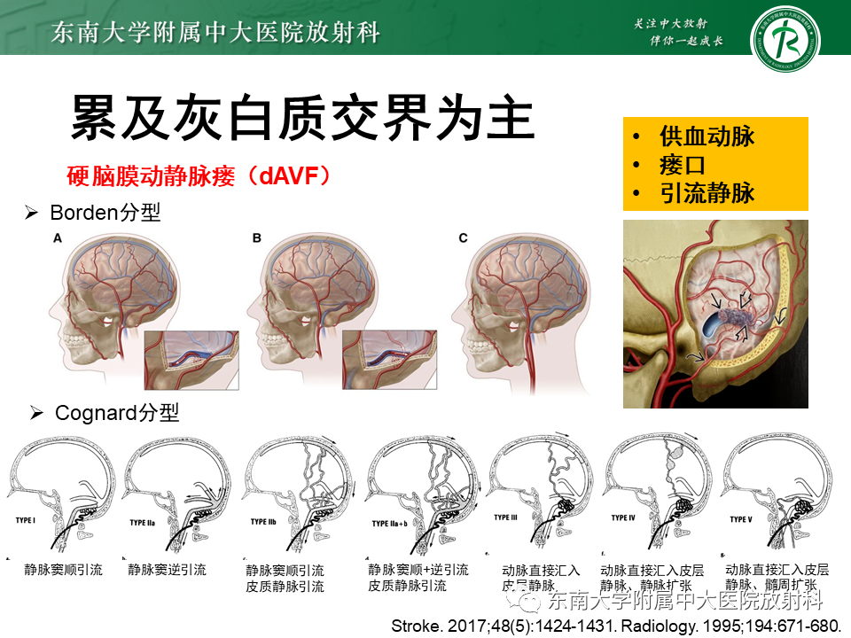 影像PPT - 【PPT】颅内多发钙化病例随诊-35