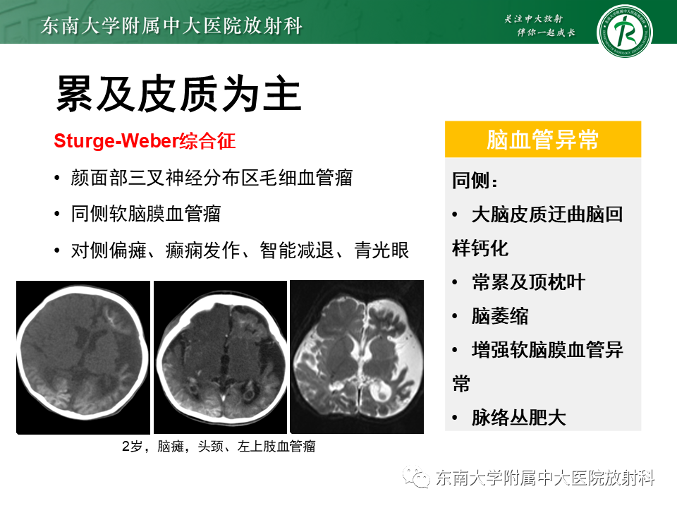 影像PPT - 【PPT】颅内多发钙化病例随诊-40