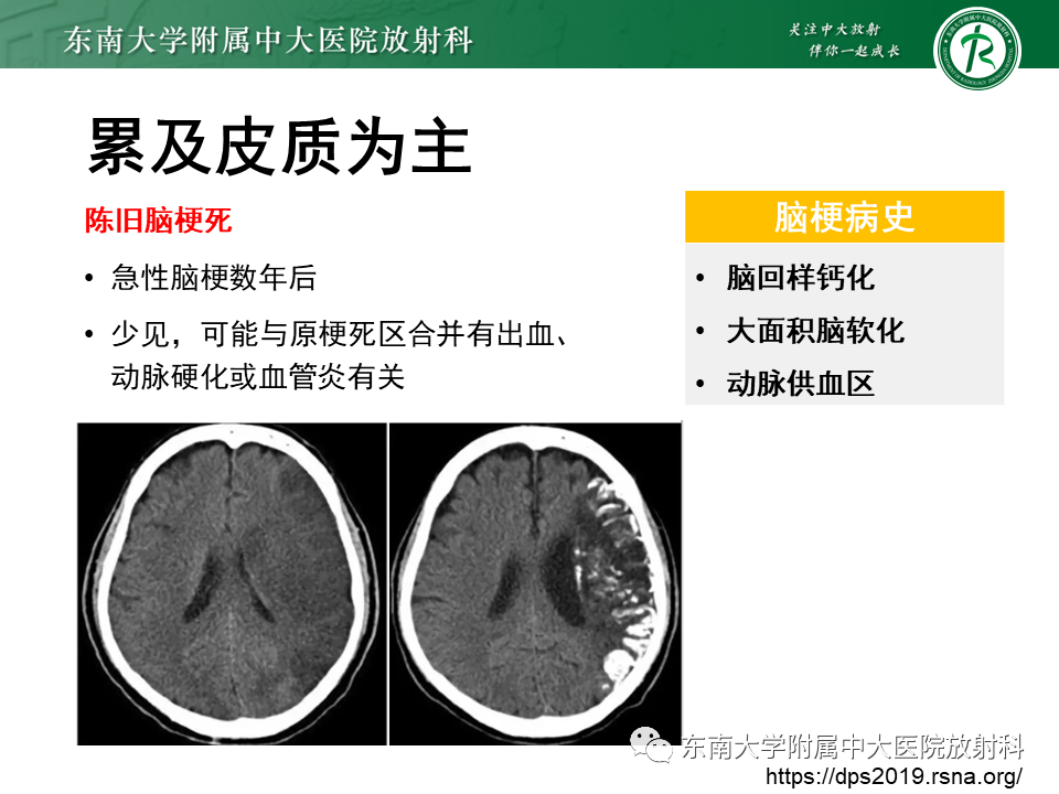 影像PPT - 【PPT】颅内多发钙化病例随诊-39