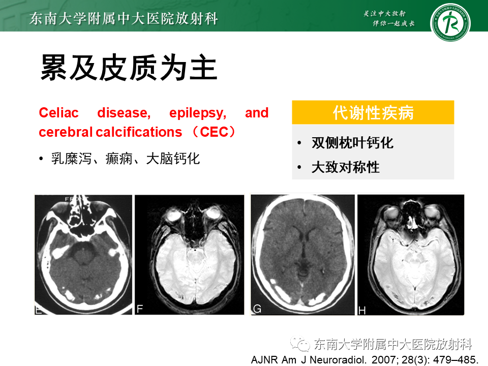 影像PPT - 【PPT】颅内多发钙化病例随诊-41