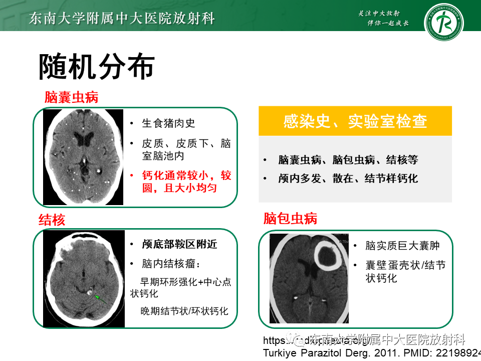 影像PPT - 【PPT】颅内多发钙化病例随诊-43