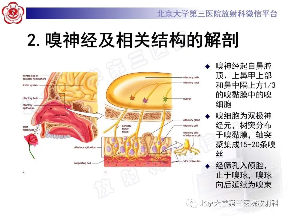 影像PPT - 【PPT】嗅神经母细胞瘤-12