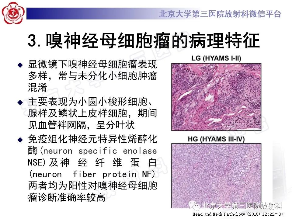 影像PPT - 【PPT】嗅神经母细胞瘤-15