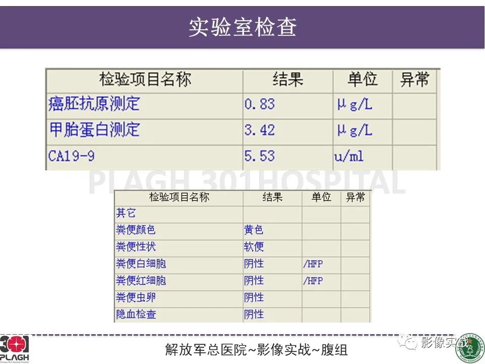 影像PPT - 【病例】直肠腺瘤1例MR影像-3