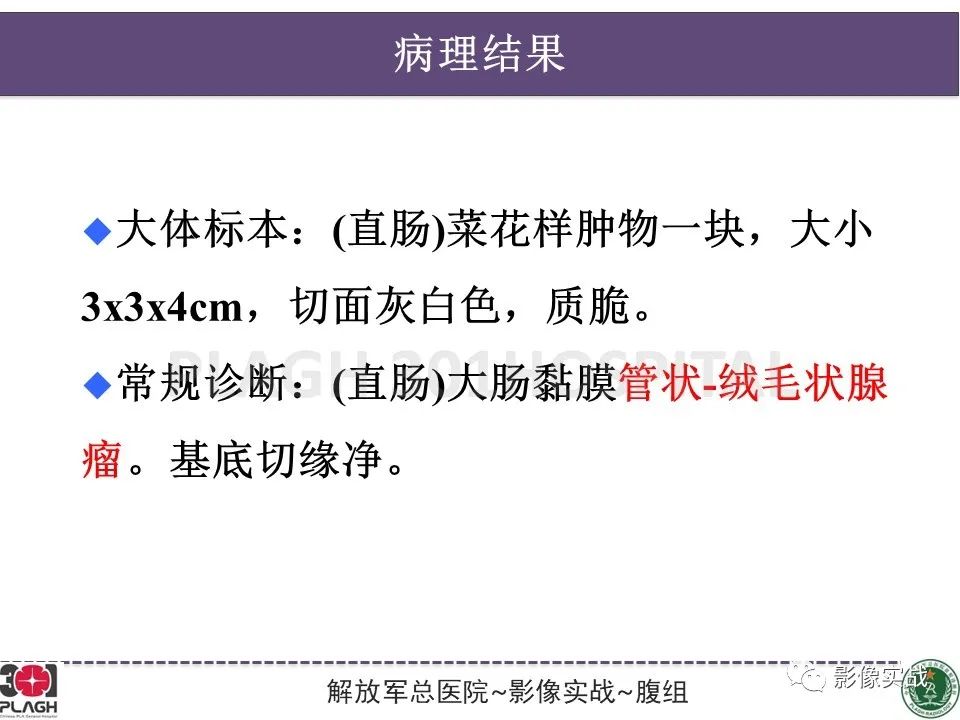 影像PPT - 【病例】直肠腺瘤1例MR影像-22