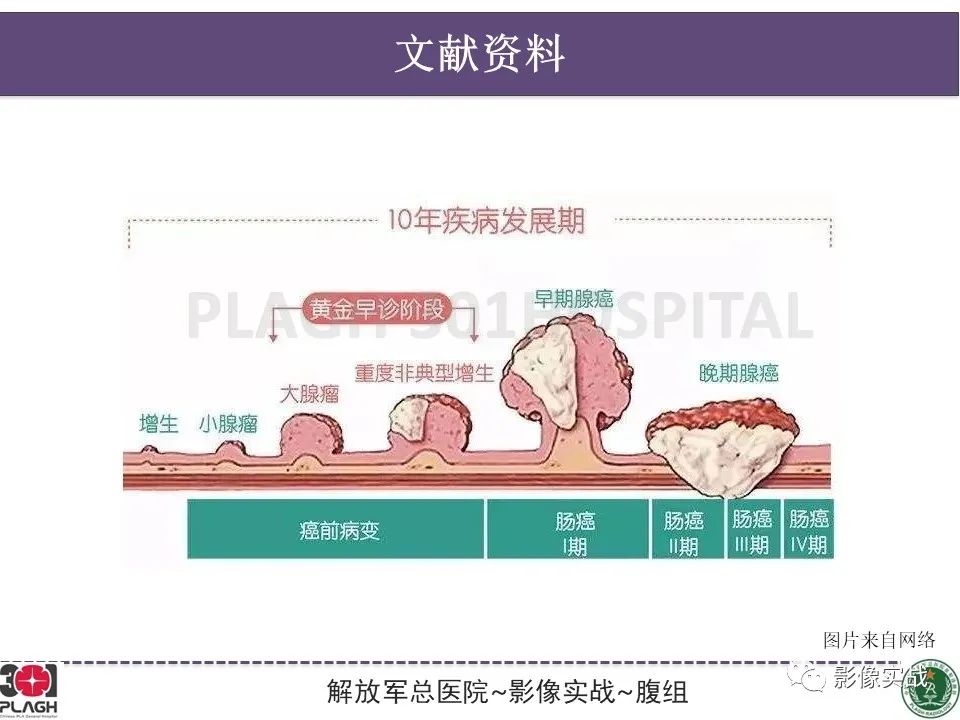 影像PPT - 【病例】直肠腺瘤1例MR影像-25