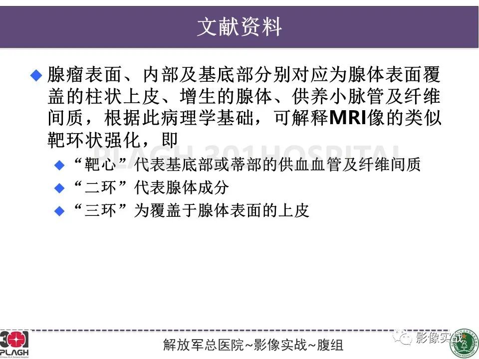 影像PPT - 【病例】直肠腺瘤1例MR影像-26