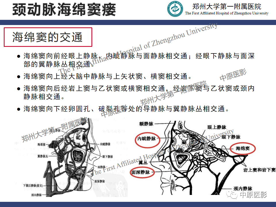 影像PPT - 【病例】颈动脉海绵窦瘘1例MR影像-16