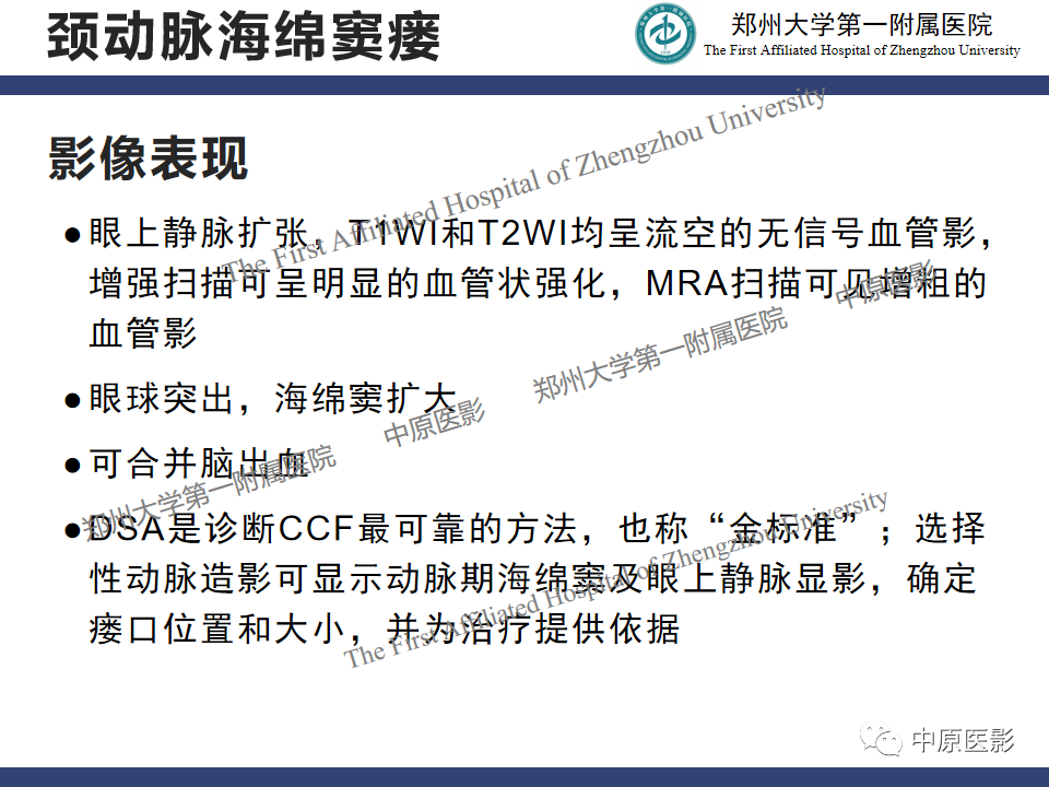 影像PPT - 【病例】颈动脉海绵窦瘘1例MR影像-19
