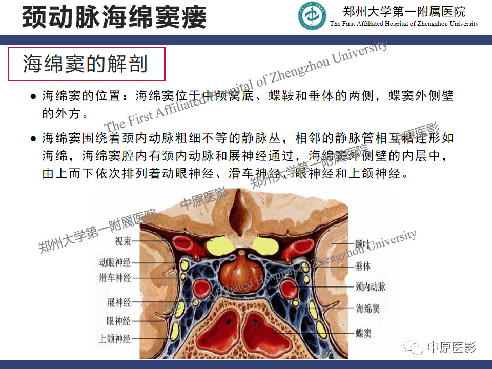 影像PPT - 【病例】颈动脉海绵窦瘘1例MR影像-1