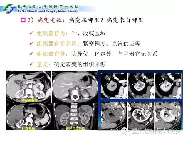 影像PPT - 【PPT】CT、MRI诊断原则与报告规范-5