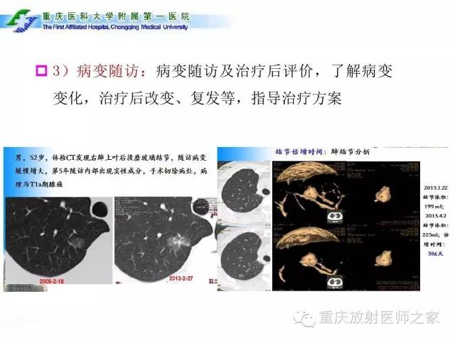 影像PPT - 【PPT】CT、MRI诊断原则与报告规范-10