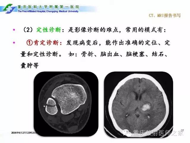 影像PPT - 【PPT】CT、MRI诊断原则与报告规范-27