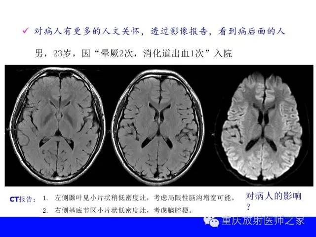 影像PPT - 【PPT】CT、MRI诊断原则与报告规范-37