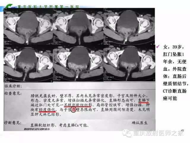 影像PPT - 【PPT】CT、MRI诊断原则与报告规范-45