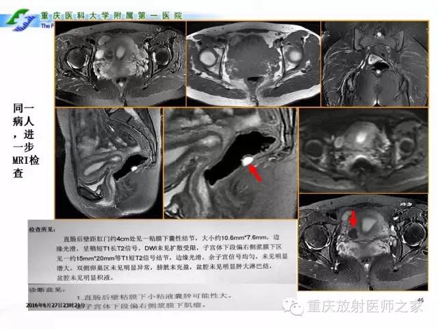 影像PPT - 【PPT】CT、MRI诊断原则与报告规范-46