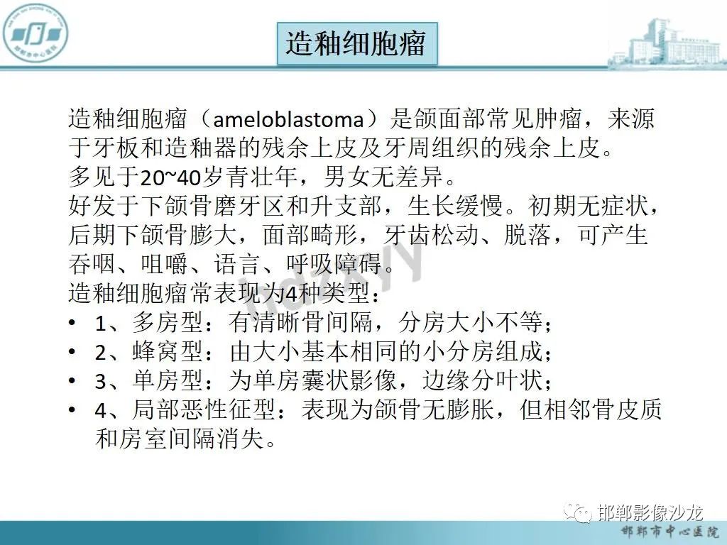 影像PPT - 【病例】牙源性纤维瘤1例CT影像诊断-12 影像PPT - 【病例】牙源性纤维瘤1例CT影像诊断-12
