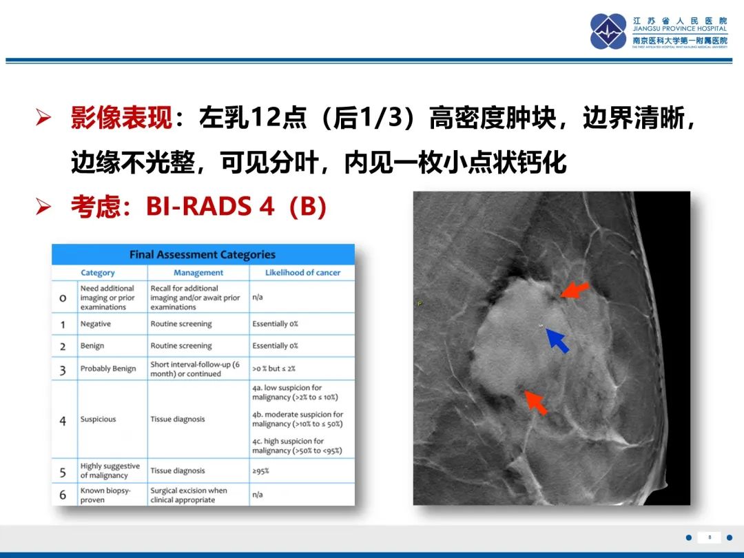 影像PPT - 【PPT】乳腺叶状肿瘤-9